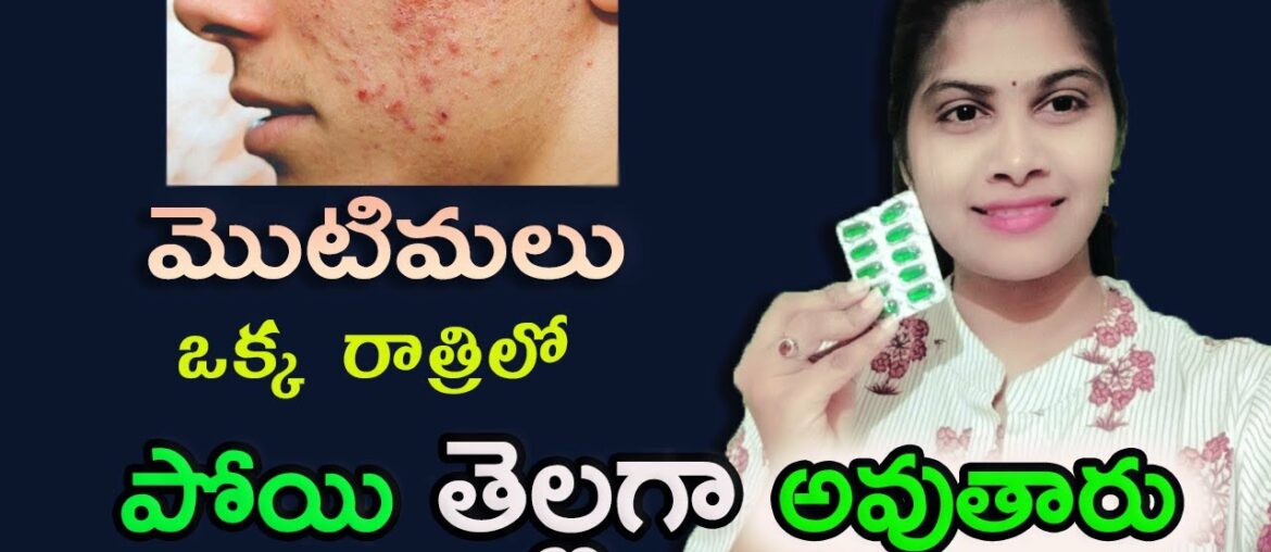 remove pimples & Lighten your Skin with Vitamin E Captules telugu || Beauty tips telugu