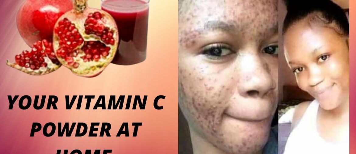 How To Make Vitamin C Powder At Home|DIY Vitamin C Powder At Home With #Pomegranatefruits|