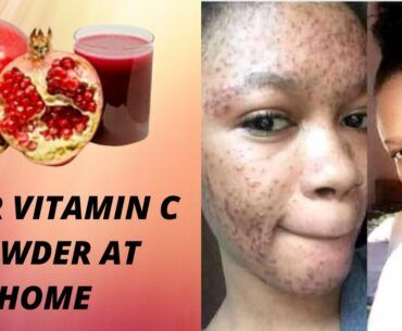 How To Make Vitamin C Powder At Home|DIY Vitamin C Powder At Home With #Pomegranatefruits|