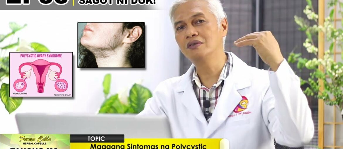 TMSD EP33 | Maagang sintomas ng Polycystic Ovary Syndrome (PCOS)