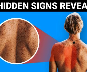 10 Hidden signs of Vitamin D deficiency (DON'T IGNORE !) - Brainzack
