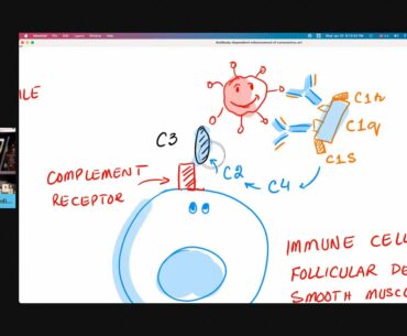 Cytokine Storm with ADE - Antibody-dependent Enhancement of Coronavirus
