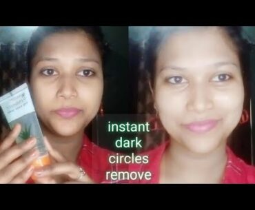 Alovera & Vitamin E oil for dark circles remove / By Beauty look book