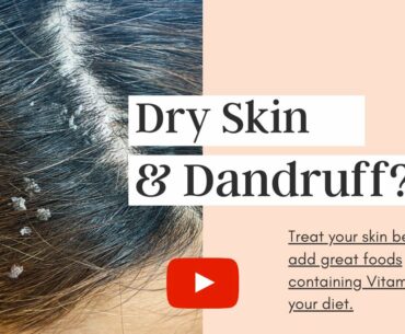 Vitamin A, Health Benefits, Deficiency,Symptoms, functional foods & supplements.