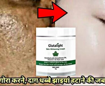 Get Bright Skin with GLUTATHION |100% PERMANENT Results|PIGMENTATION, SPOTS, MARKS  & SKIN WHITENING