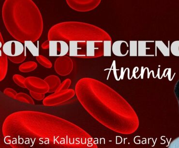 Iron Deficiency Anemia - Dr. Gary Sy