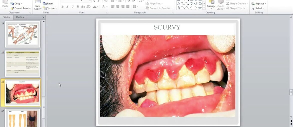 Grade 9 Integrated Science - Part 2 of Nutrition In Animals (With Ms. Subryan)