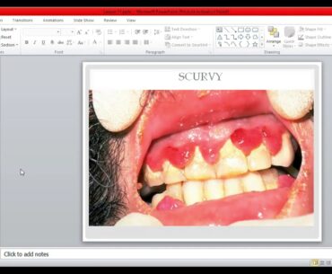 Grade 9 Integrated Science - Part 2 of Nutrition In Animals (With Ms. Subryan)