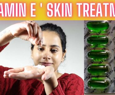 VITAMIN E OIL SKIN TREATMENT |GET BEAUTIFUL SPOTLESS,GLOWING SKIN| ROOTZ BY DAMINI