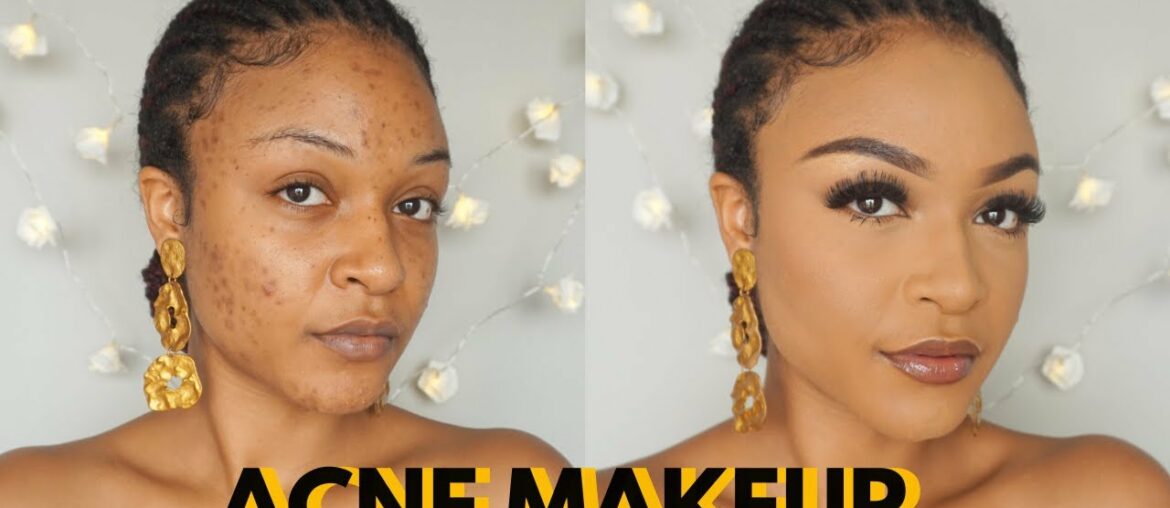 Cover acne and dark spots | Get flawless skin | Makeup Transformation
