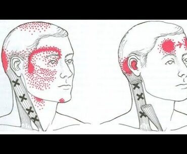 If You Miss This Vitamin From Your Diet, You Will Get Migraines And Headaches