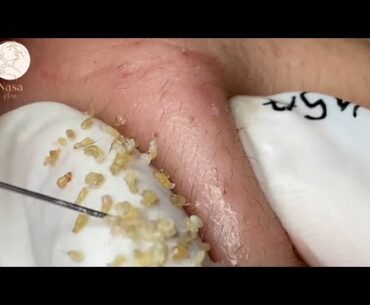 Satisfying Relaxing With QuynhGiao Beauty Spa _061