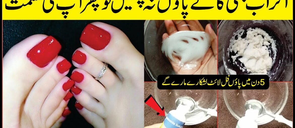 You Need To Follow This! 5 Days For Tanning Free Whiter & Glowing Feet At Home: Beauty Tips At Home: