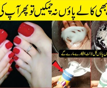 You Need To Follow This! 5 Days For Tanning Free Whiter & Glowing Feet At Home: Beauty Tips At Home: