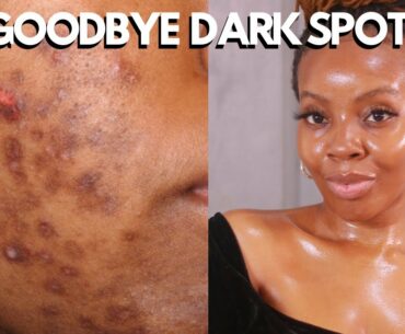 ASCORBIC ACID VITAMIN C | ASCORBIC ACID 8+ALPHA ARBUTIN 2| TRUTH ABOUT THE ORDINARY| bye dark spots