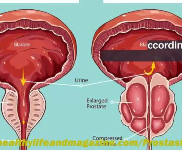ProstaStream Review UK 2021 United Kingdom Reviews Get Now!