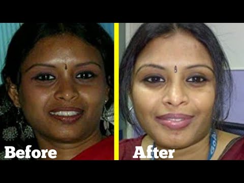 Fair skin face cream | AYUNEEM BEAUTY CREAM | Spotless skin | Skin care | Beauty | Brijwasi Girl