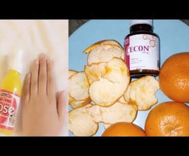 importance of vitamin c in human body systems