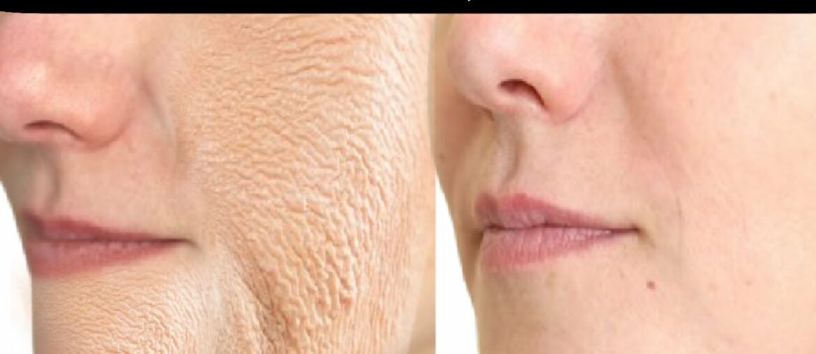 ANTI - AGING, LIFT TIGHTEN, TRANSFORM YOUR SKIN, BOOST COLLAGEN, LOOK YEARS YOUNGER, BEAUTY CREAM