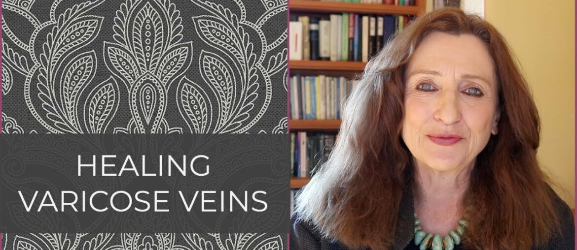 Top Natural Remedies for Varicose Veins - Feb 1, 2021 - Medica Nova Wellness Studio