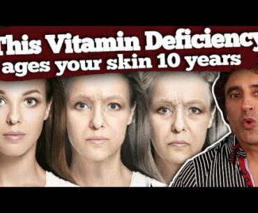THIS ONE VITAMIN DEFICIENCY WRINKLING YOUR FACE // Vitamins for Skin