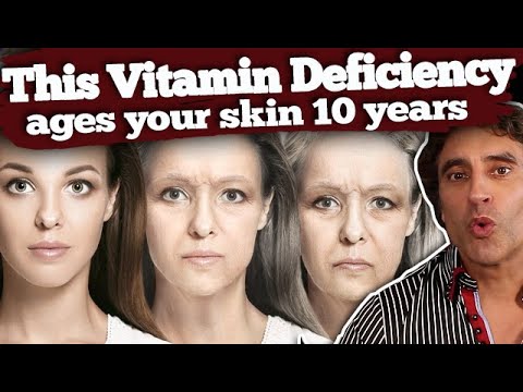 THIS ONE VITAMIN DEFICIENCY WRINKLING YOUR FACE // Vitamins for Skin