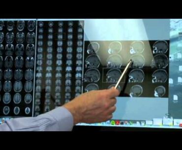 Vitamin D Supplements Might Slow Dementia