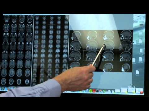 Vitamin D Supplements Might Slow Dementia