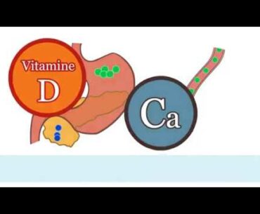 Effect of Vitamin D and Calcium intake on type 2 diabetes