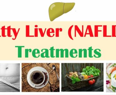 How to Treat & Reverse A Fatty Liver | Exercise & Diet Methods for Non-Alcoholic Fatty Liver Disease