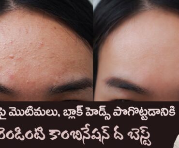 Remove Pimples and Dead Cells | Vitamin C Face Pack | Bright and Fair Skin |Dr.Manthena's Beauty Tip