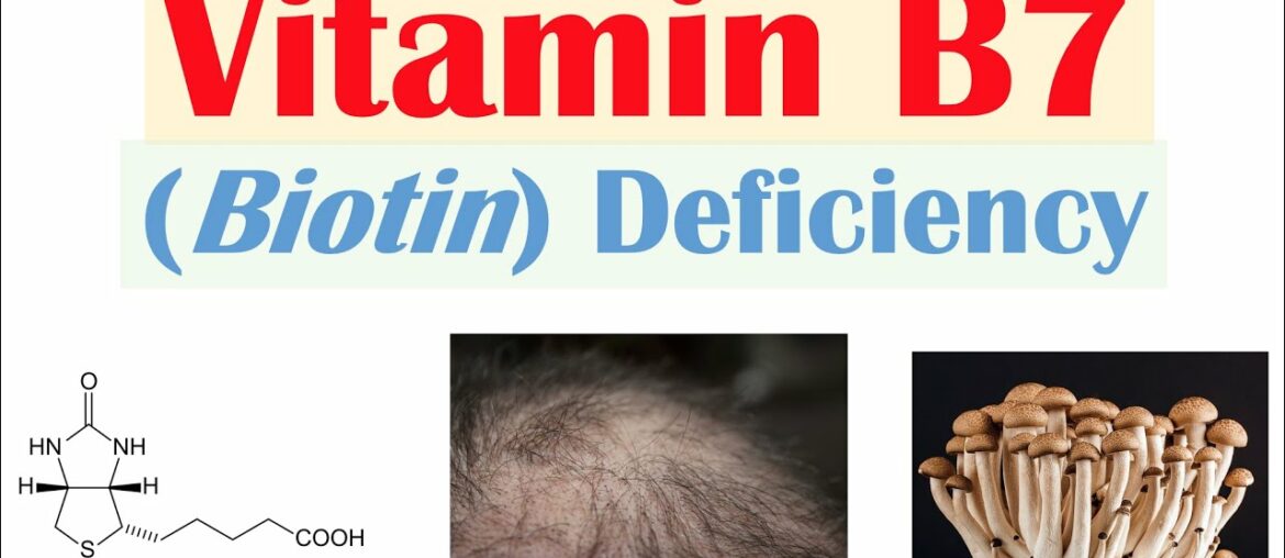 Vitamin B7 Biotin Deficiency | Sources, Purposes, Causes, Symptoms, Diagnosis, Treatment