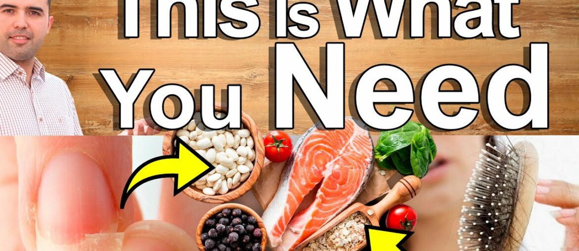 THIS IS WHAT YOUR HAIR, SKIN, and NAILS NEED - Top Supplements, Vitamin and Minerals for Beauty