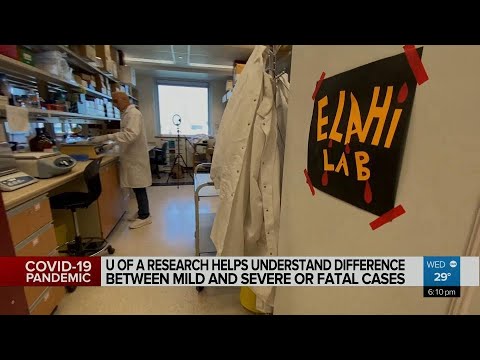 Protein in blood could be indicator for sever COVID-19 cases: Study