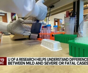 Protein in blood could be indicator for severe COVID-19 cases: Study