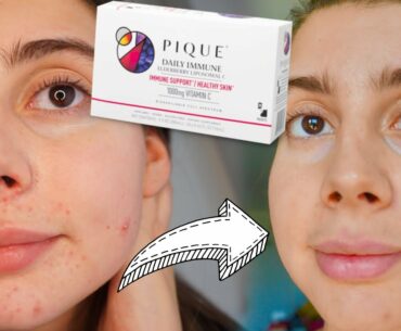 I TESTED 2 WEEKS OF VITAMIN C SUPPLEMENTS FOR CLEAR SKIN || Does Pique Tea Work!?!?