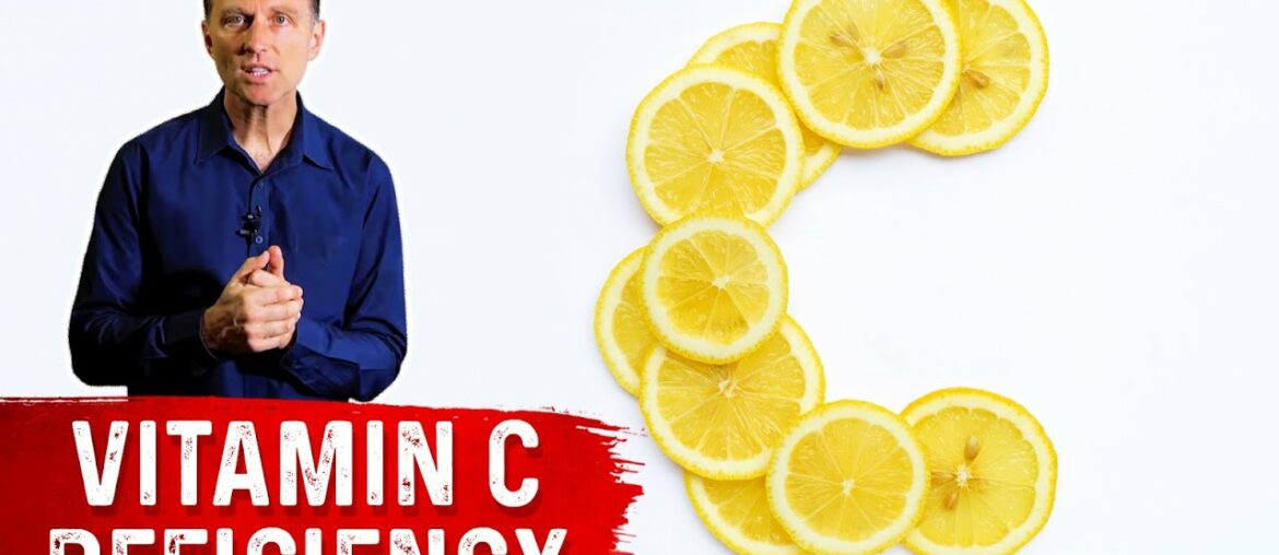 Eighty-two Percent of COVID-19 Patients Were Deficient in Vitamin C