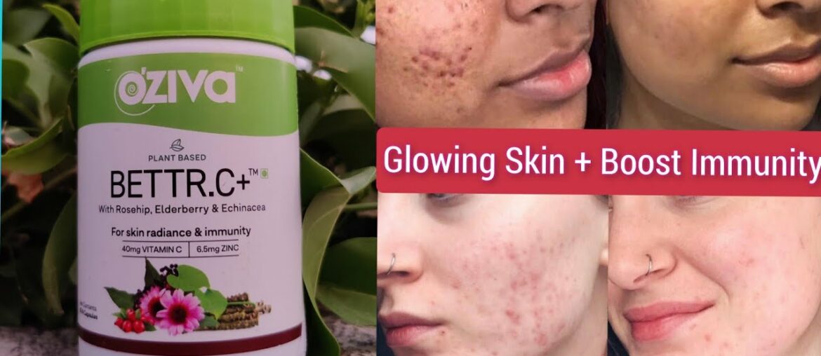 Oziva Vitamin C Supplements Review | Vitamin C for Skin Whitening + Immunity