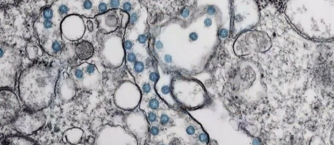 Natural immune system vs COVID-19 | Health Beat with Brea Love