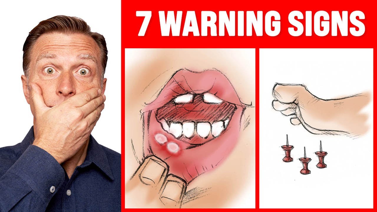 The 7 WARNING Signs of a B12 Deficiency Dr. Berg Vitamin Rush