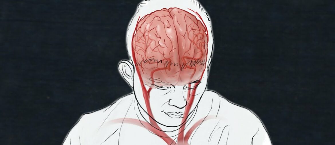 Here’s what we know about COVID-19’s impact on the brain