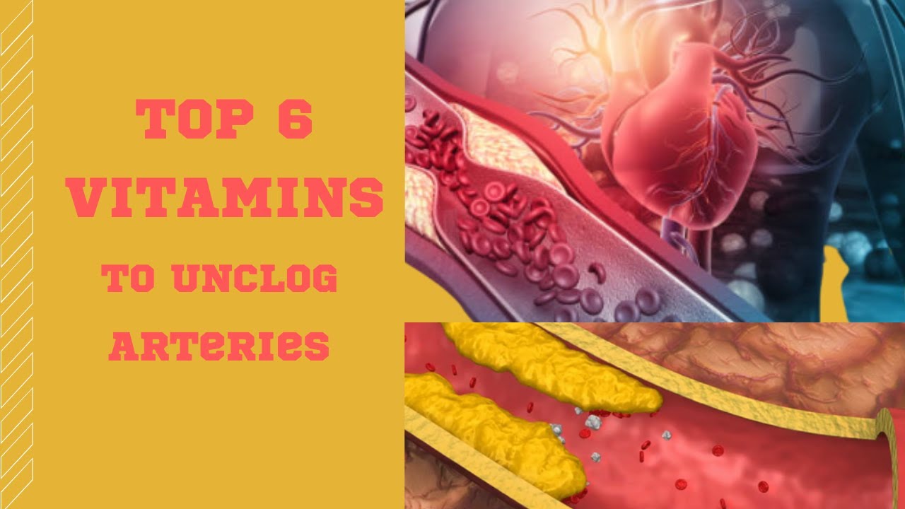 Top 6 Vitamins To UNCLOG Your ARTERIES Vitamin Rush