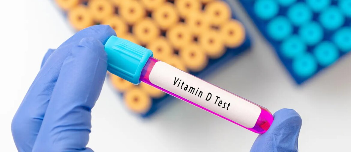 A photo of a test tube of blood labeled: Vitamin D Test, held in a blue rubber gloved hand.