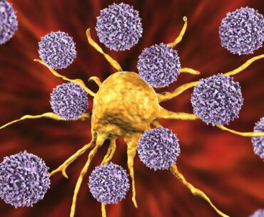 Preoperative Radiation May Improve Antitumor Immune Response in Most Common Form of Breast Cancer