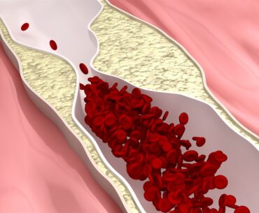Immune cell energy metabolism shapes the progression of atherosclerosis