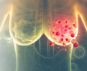 Preventive TNBC Vaccine Triggers Immune Responses in Phase I Study