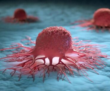 This One Vitamin May Be Silently Protecting You From Cancer — Are You Getting Enough? – Patna Press