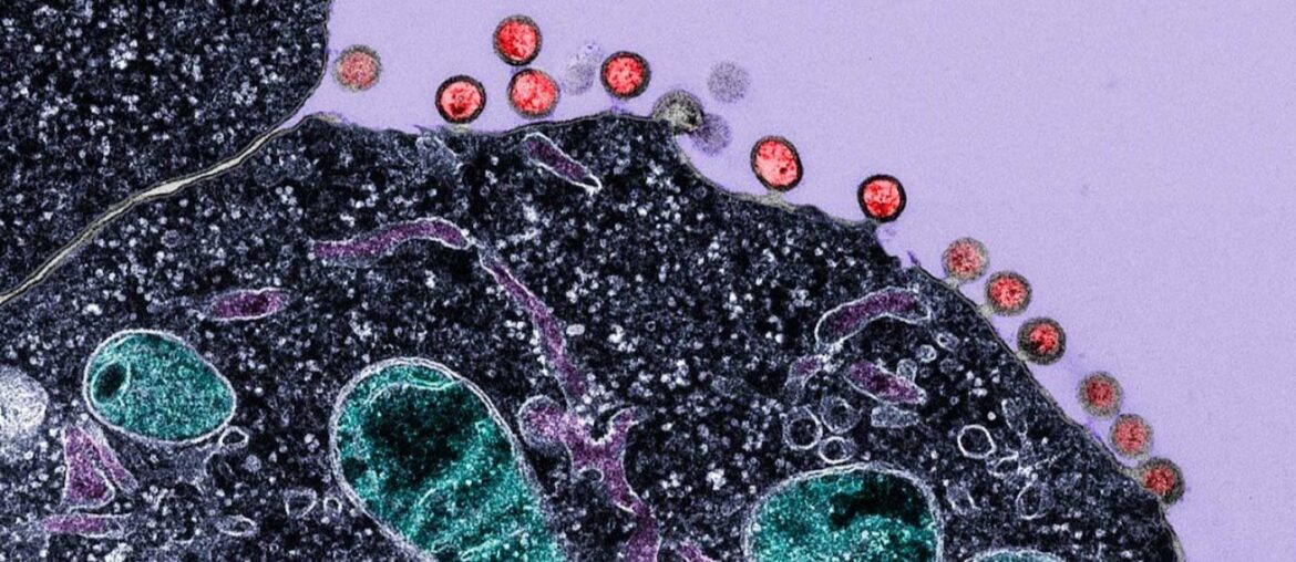 New Immune Treatment May Suppress HIV—No Daily Pills Required