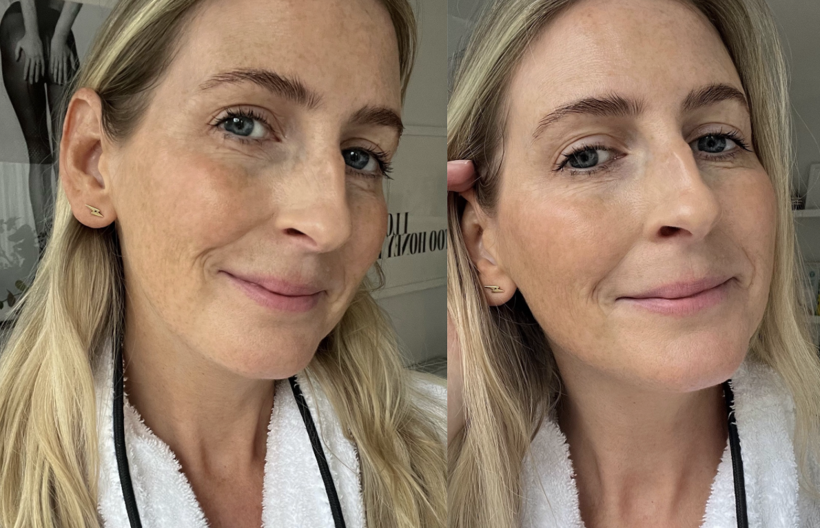 40+ Skincare, Beauty editor