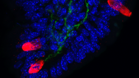 Pain-sensing neurons kick-start immune responses